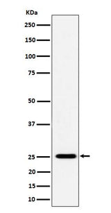 Anti-CFD Rabbit Monoclonal Antibody Boster Bio