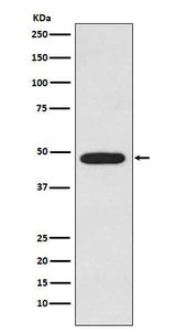 Anti-Galactosidase alpha Rabbit Monoclonal Antibody Boster Bio