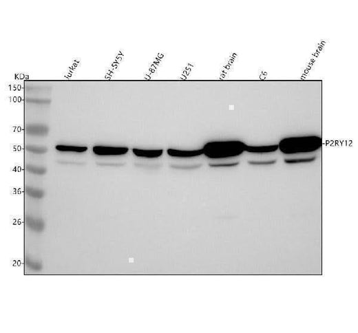 Anti-P2Y12 Rabbit Monoclonal Antibody Boster Bio
