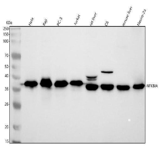Anti-IKB alpha NFKBIA Rabbit Monoclonal Antibody Boster Bio