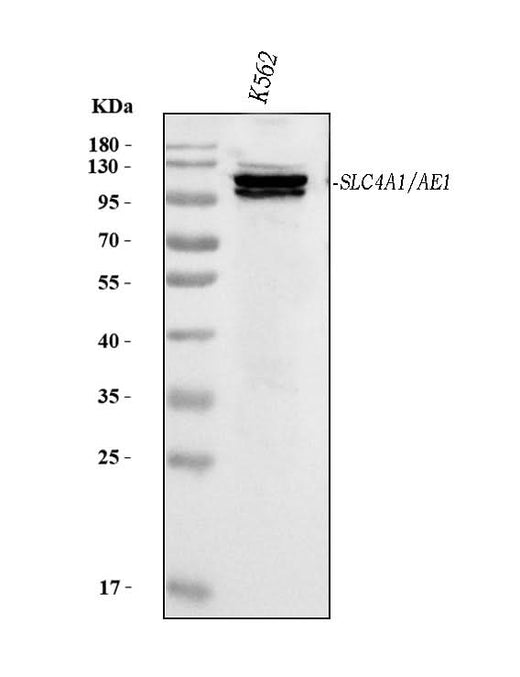 Anti-SLC4A1/CD233/Band 3 Antibody Picoband® (monoclonal, 5G2G7 Boster Bio