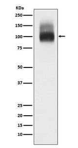 Anti-SLC4A1/CD233/Band 3 Rabbit Monoclonal Antibody Boster Bio