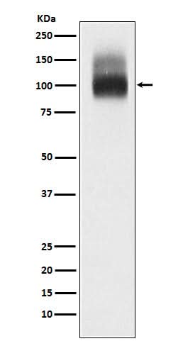 Anti-SLC4A1/CD233/Band 3 Rabbit Monoclonal Antibody Boster Bio