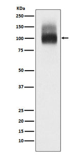 Anti-SLC4A1/CD233/Band 3 Rabbit Monoclonal Antibody Boster Bio