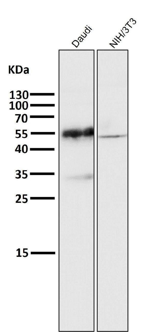 Anti-CD27 Rabbit Monoclonal Antibody Boster Bio