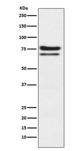 Anti-PKC epsilon Monoclonal Antibody Boster Bio