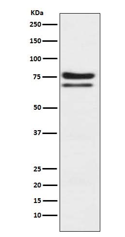 Anti-PKC epsilon Monoclonal Antibody Boster Bio