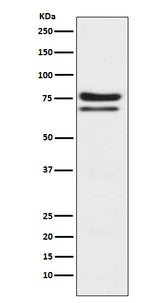 Anti-PKC epsilon Monoclonal Antibody Boster Bio