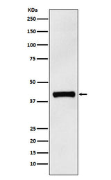 Anti-IL12 p40 Rabbit Monoclonal Antibody Boster Bio