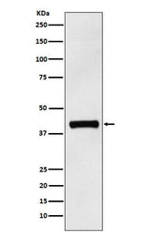 Anti-IL12 p40 Rabbit Monoclonal Antibody Boster Bio