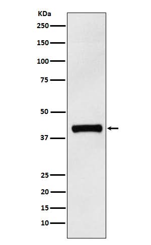Anti-IL12 p40 Rabbit Monoclonal Antibody Boster Bio