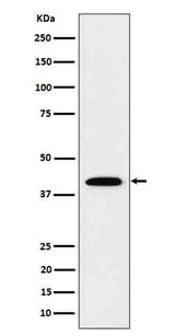 Anti-IL12B Rabbit Monoclonal Antibody Boster Bio