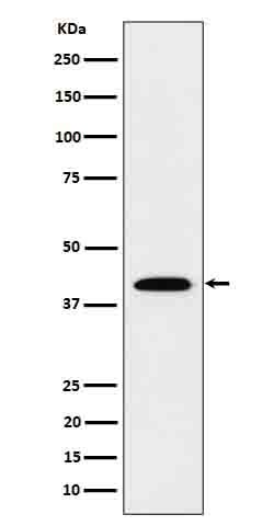 Anti-IL12B Rabbit Monoclonal Antibody Boster Bio