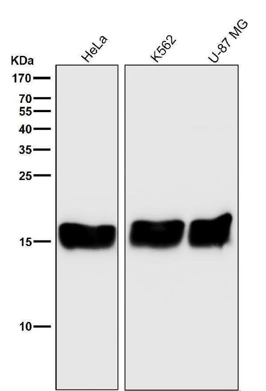 Anti-PBR TSPO Rabbit Monoclonal Antibody Boster Bio