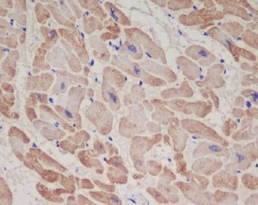 Anti-Troponin T TNNT2 Rabbit Monoclonal Antibody Boster Bio