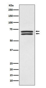 Anti-PDPK1/Pdk 1 Rabbit Monoclonal Antibody Boster Bio