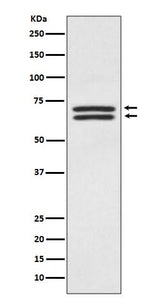 Anti-PDPK1/Pdk 1 Rabbit Monoclonal Antibody Boster Bio