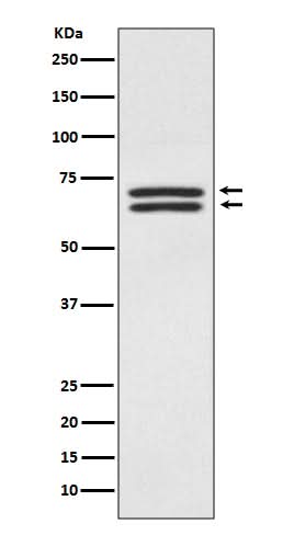 Anti-PDPK1/Pdk 1 Rabbit Monoclonal Antibody Boster Bio