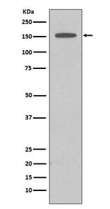 Anti-DAP Kinase 1 DAPK1 Rabbit Monoclonal Antibody Boster Bio