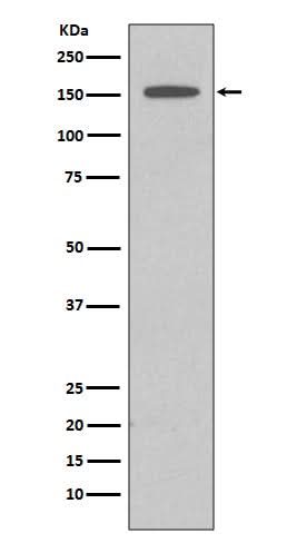 Anti-DAP Kinase 1 DAPK1 Rabbit Monoclonal Antibody Boster Bio