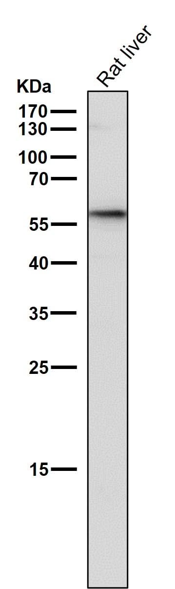 Anti-GBA/Glucosylceramidase Rabbit Monoclonal Antibody Boster Bio