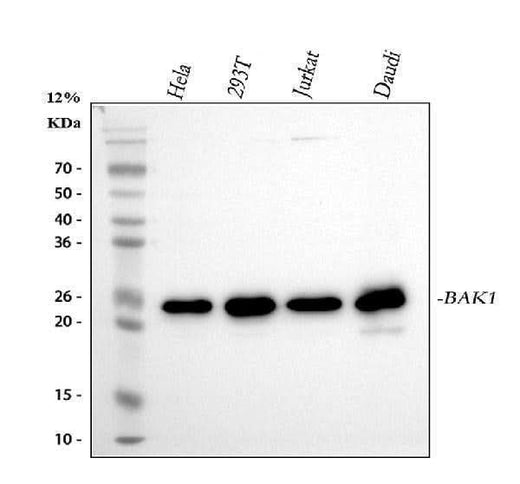 Anti-Bak BAK1 Rabbit Monoclonal Antibody Boster Bio