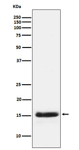 Anti-PLGF Rabbit Monoclonal Antibody Boster Bio