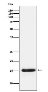 Anti-PLGF Rabbit Monoclonal Antibody Boster Bio