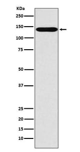 Anti-SLC9A1 Rabbit Monoclonal Antibody Boster Bio