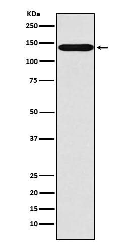 Anti-SLC9A1 Rabbit Monoclonal Antibody Boster Bio