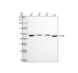 Anti-AP2 alpha Rabbit Monoclonal Antibody Boster Bio