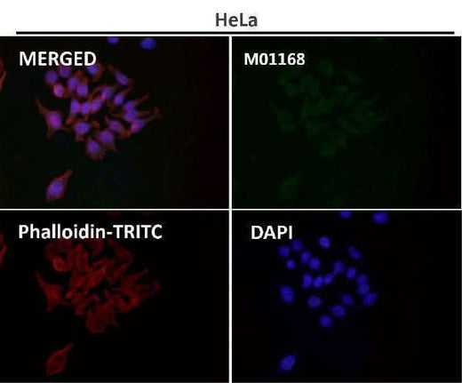 Anti-VDAC1/Porin Rabbit Monoclonal Antibody Boster Bio