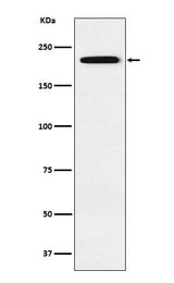 Anti-Gli3 Rabbit Monoclonal Antibody Boster Bio