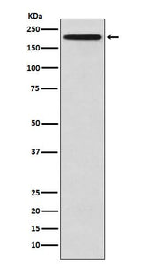 Anti-GCN2 EIF2AK4 Rabbit Monoclonal Antibody Boster Bio