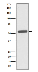 Anti-PKM2 Rabbit Monoclonal Antibody Boster Bio