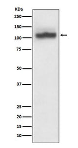 Anti-SERCA2 ATP2A2 Rabbit Monoclonal Antibody Boster Bio
