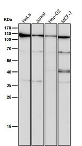 Anti-CRM1 Rabbit Monoclonal Antibody Boster Bio