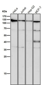 Anti-CRM1 Rabbit Monoclonal Antibody Boster Bio