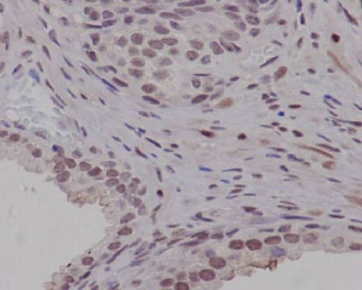Anti-PIM1 Rabbit Monoclonal Antibody Boster Bio