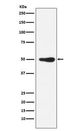 Anti-FOXL2 Rabbit Monoclonal Antibody Boster Bio