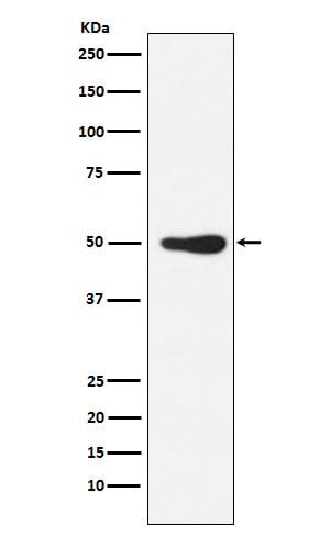 Anti-FOXL2 Rabbit Monoclonal Antibody Boster Bio