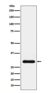 Anti-BNP Rabbit Monoclonal Antibody Boster Bio