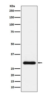 Anti-BNP Rabbit Monoclonal Antibody Boster Bio