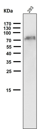Anti-NGFR/P75 Rabbit Monoclonal Antibody Boster Bio