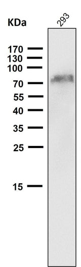 Anti-NGFR/P75 Rabbit Monoclonal Antibody Boster Bio