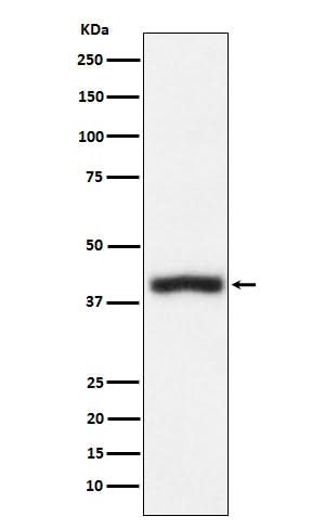 Anti-CD1c Rabbit Monoclonal Antibody Boster Bio