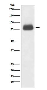 Anti-CD36/Sr B3 Rabbit Monoclonal Antibody Boster Bio