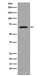 Anti-CDC7 Rabbit Monoclonal Antibody Boster Bio