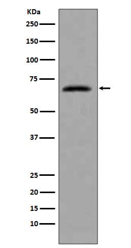 Anti-CDC7 Rabbit Monoclonal Antibody Boster Bio