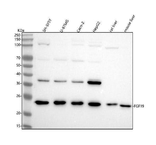 Anti-FGF19 Rabbit Monoclonal Antibody Boster Bio